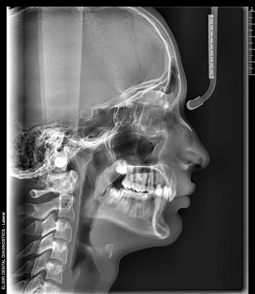Sample lateral cephalometric X-ray